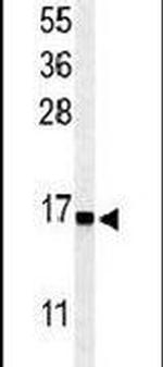 RPS25 Antibody in Western Blot (WB)
