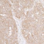 Ribosomal Protein S3A/RPS3A Antibody in Immunohistochemistry (IHC)