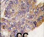 RSK1 Antibody in Immunohistochemistry (IHC)