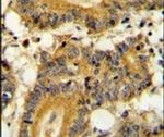 RSK1 Antibody in Immunohistochemistry (IHC)