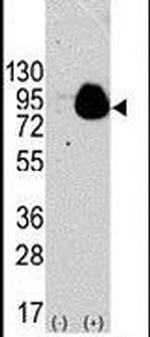 RSK1 Antibody in Western Blot (WB)