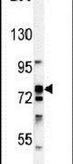 RSK1 Antibody in Western Blot (WB)