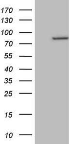 RPS6KA2 Antibody in Western Blot (WB)