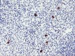 RPS6KB1 Antibody in Immunohistochemistry (Paraffin) (IHC (P))