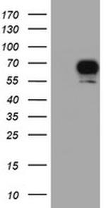 RPS6KB1 Antibody in Western Blot (WB)