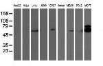 RPS6KB1 Antibody in Western Blot (WB)