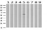 RPS6KB1 Antibody in Western Blot (WB)