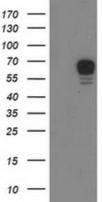 RPS6KB1 Antibody in Western Blot (WB)