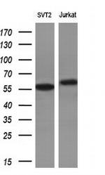 RPS6KB1 Antibody in Western Blot (WB)