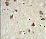 RPS6KB2 Antibody in Immunohistochemistry (IHC)