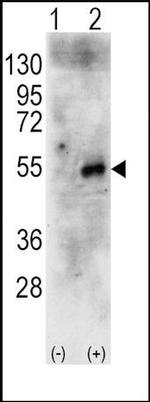 RPS6KB2 Antibody in Western Blot (WB)