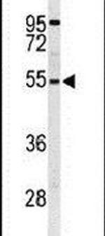 RPS6KB2 Antibody in Western Blot (WB)