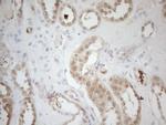 RPS6KC1 Antibody in Immunohistochemistry (Paraffin) (IHC (P))