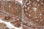 RPSA Antibody in Immunohistochemistry (Paraffin) (IHC (P))
