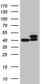 RPSA Antibody in Western Blot (WB)