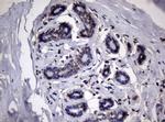 RRM1 Antibody in Immunohistochemistry (Paraffin) (IHC (P))