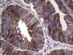 RRM1 Antibody in Immunohistochemistry (Paraffin) (IHC (P))