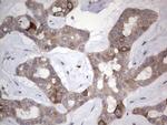 RRM1 Antibody in Immunohistochemistry (Paraffin) (IHC (P))