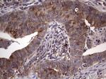 RRM1 Antibody in Immunohistochemistry (Paraffin) (IHC (P))