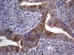 RRM1 Antibody in Immunohistochemistry (Paraffin) (IHC (P))
