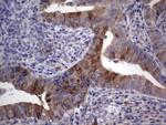 RRM1 Antibody in Immunohistochemistry (Paraffin) (IHC (P))