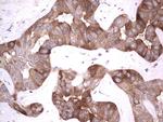 RRM1 Antibody in Immunohistochemistry (Paraffin) (IHC (P))