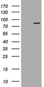 RRM1 Antibody in Western Blot (WB)