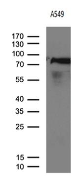 RRM1 Antibody in Western Blot (WB)