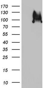RRM1 Antibody in Western Blot (WB)