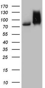 RRM1 Antibody in Western Blot (WB)