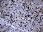 RRM2 Antibody in Immunohistochemistry (Paraffin) (IHC (P))
