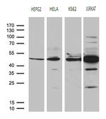 RRM2 Antibody in Western Blot (WB)