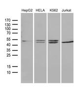 RRM2 Antibody in Western Blot (WB)