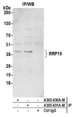 RRP15 Antibody in Western Blot (WB)