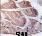 RSK2 Antibody in Immunohistochemistry (IHC)