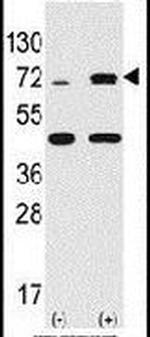 RSK2 Antibody in Western Blot (WB)