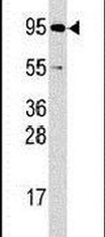 RSK2 Antibody in Western Blot (WB)