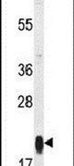 MRPS25 Antibody in Western Blot (WB)
