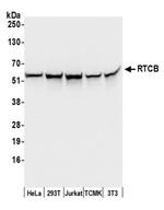 RTCB/C22orf28/FAAP Antibody in Western Blot (WB)