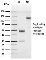 Human Herpes Virus 8 (HHV8) Monoclonal Antibody (LN53)