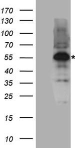 RUNX1 Antibody in Western Blot (WB)