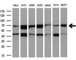 RUNX1T1 Antibody in Western Blot (WB)
