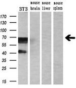 RUNX1T1 Antibody in Western Blot (WB)