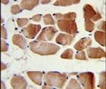 RUVBL1 Antibody in Immunohistochemistry (IHC)