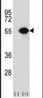 RUVBL1 Antibody in Western Blot (WB)
