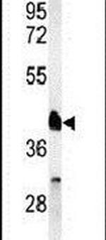RXRA Antibody in Western Blot (WB)