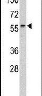 RYK Antibody in Western Blot (WB)