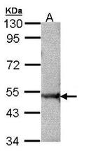Rabex-5 Antibody in Western Blot (WB)
