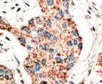 RAD9 Antibody in Immunohistochemistry (IHC)