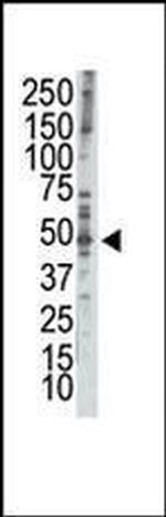 RAD9 Antibody in Western Blot (WB)